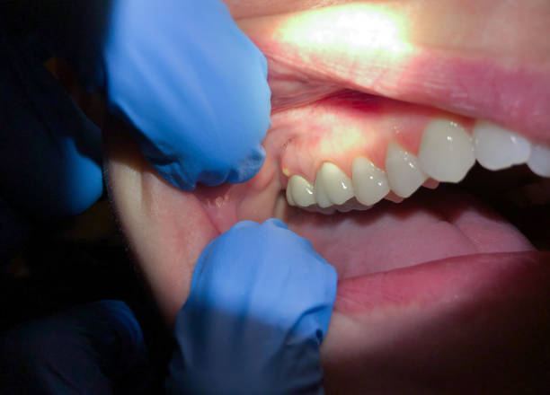 Best Mobile Emergency Dentist in Centrevle, IL