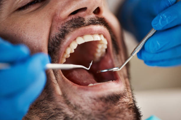 Best Orthodontic Emergency Dentist in Centrevle, IL