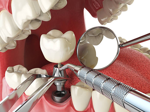 Best Emergency Cosmetic Dentistry in Centrevle, IL